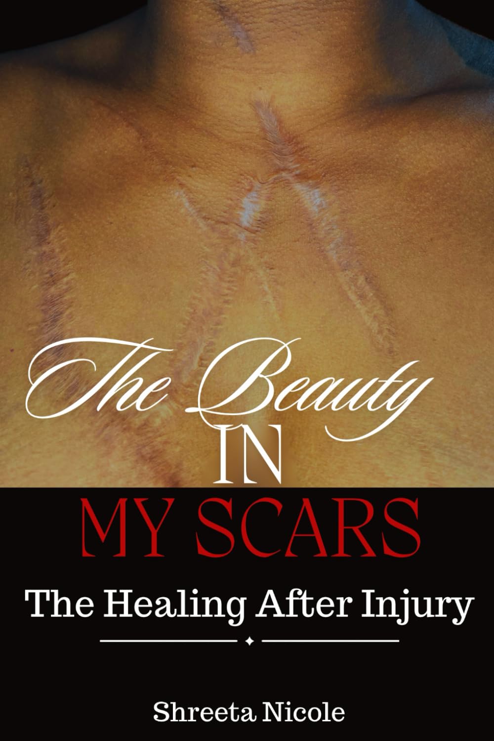 The Beauty in My Scars - book cover